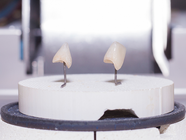 Two models of dental crowns