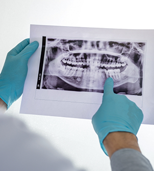 Dentist looking at an x-ray of a patient's teeth
