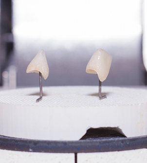 Two models of dental crowns