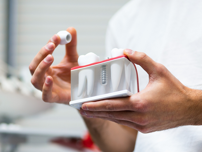 Dentist showing a model of a dental implant to a patient