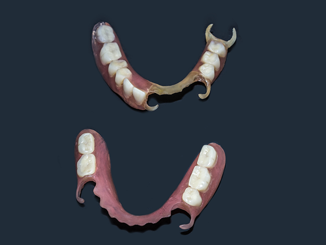 Two partial dentures