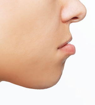 Profile of a person with an underbite