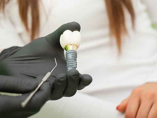 Dentist showing a dental implant to a patient