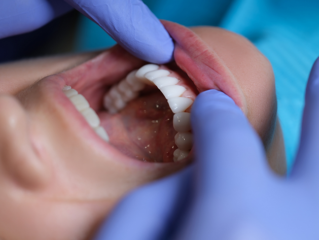 Dentist examining a patient's teeth